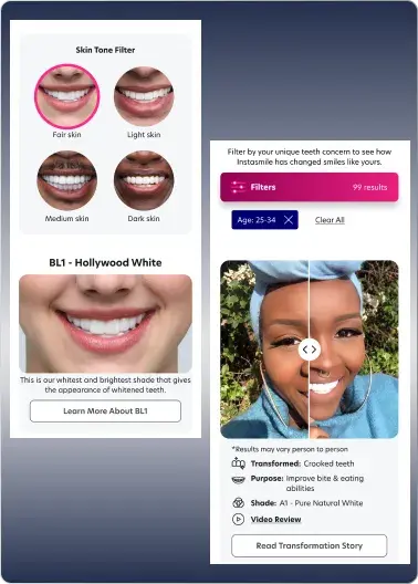 Instasmile comparison tool showing skin tone filters on the left and a before-and-after smile transformation on the right, with product shade details and transformation filters.