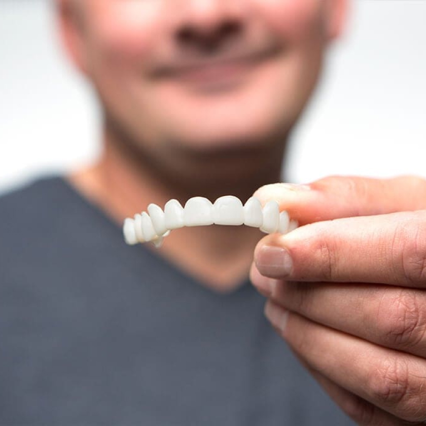 A man in a dark shirt holding a set of white dental veneers between his fingers, slightly out of focus in the background.